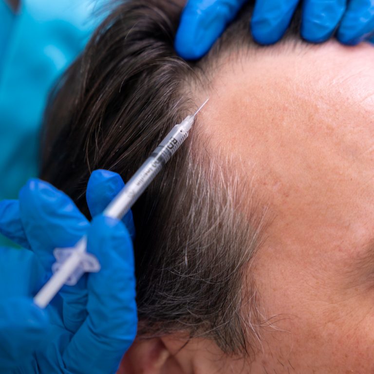 hair restoration