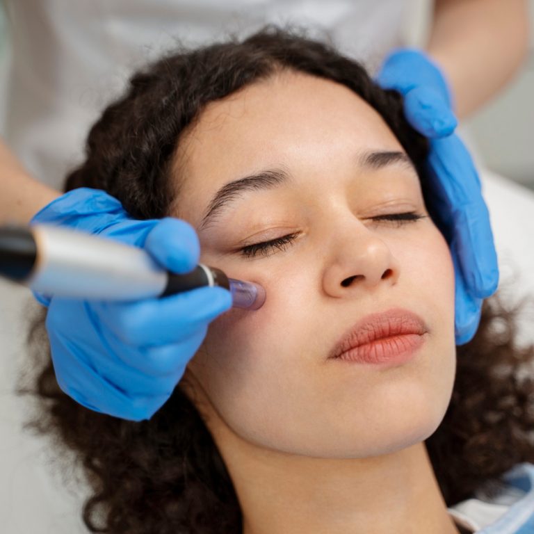 microneedling
